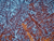 Super Alloys Ni Non Ferrous Metals